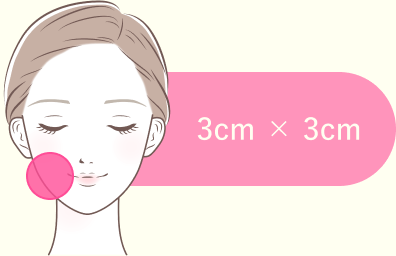 お試しスポット治療(3cm×3cm)のイメージ